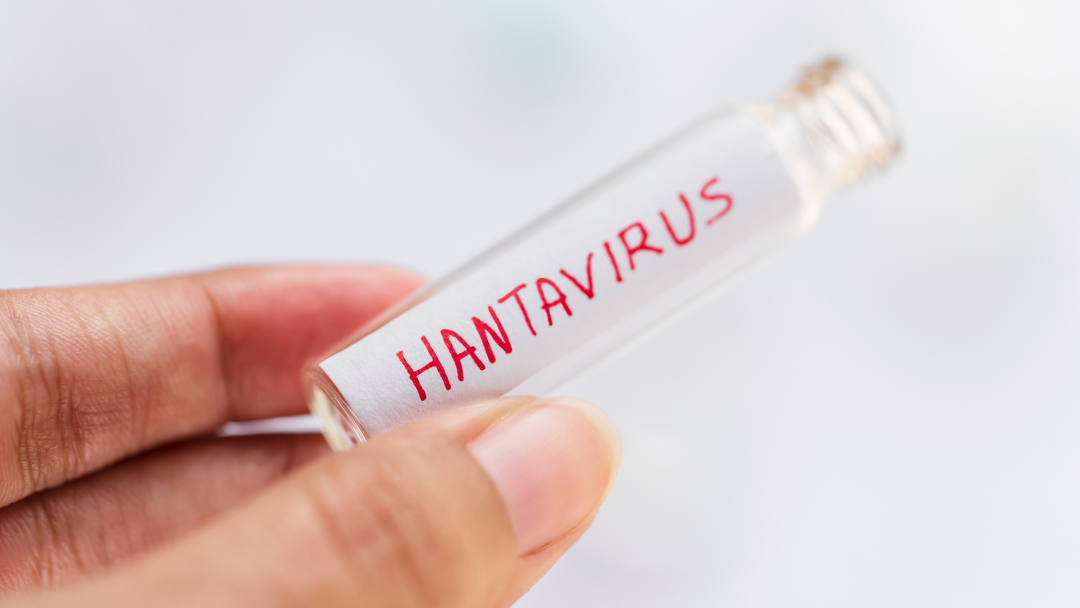 Hantavirus