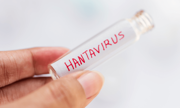 Hantavirus